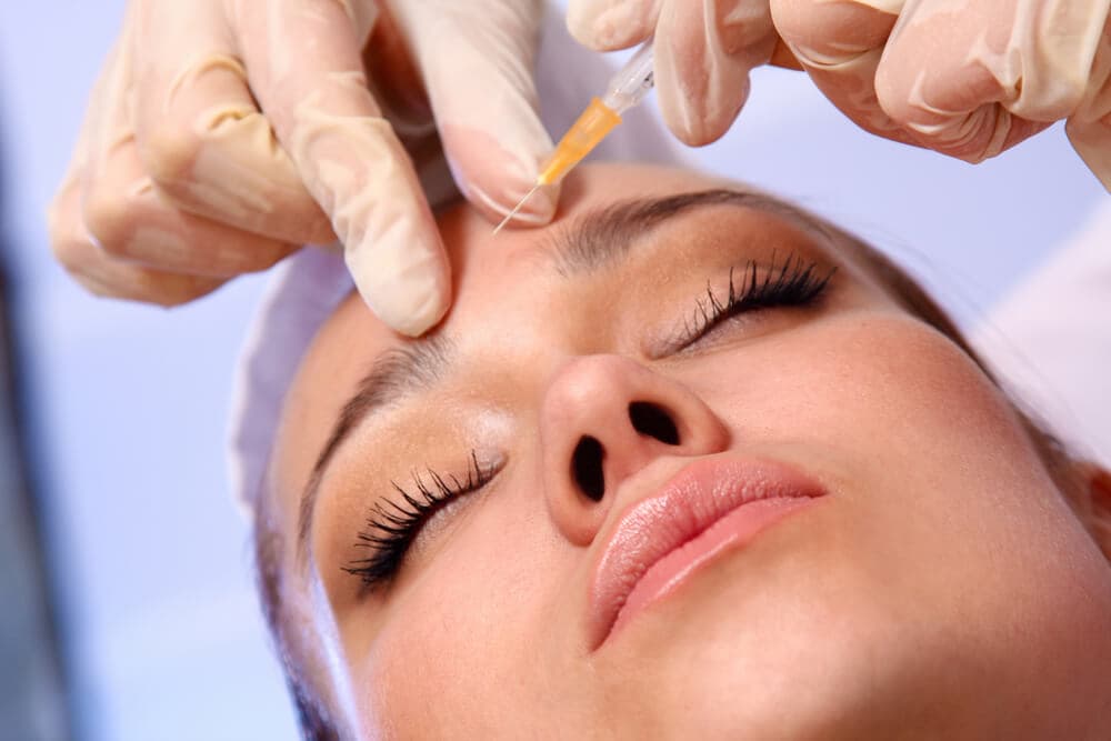 Preenchimento facial